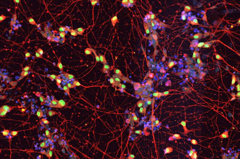 Parkinson's disease drug ropinirole safely slowed the progression of ALS for over 6 months in a clinical trial