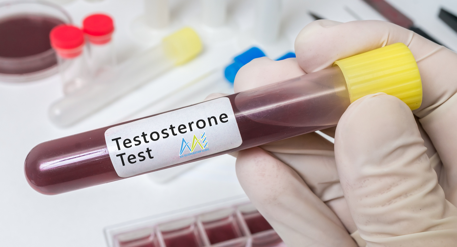 Testosterone is