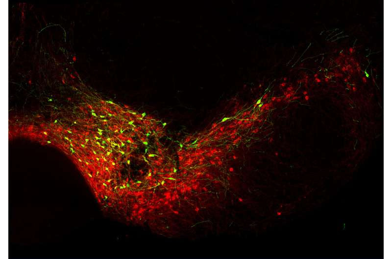 BCL11A: Evidence for neuroprotective effect