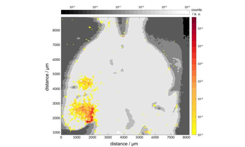 Metal-based molecules show promise against the build-up of Alzheimer’s peptides