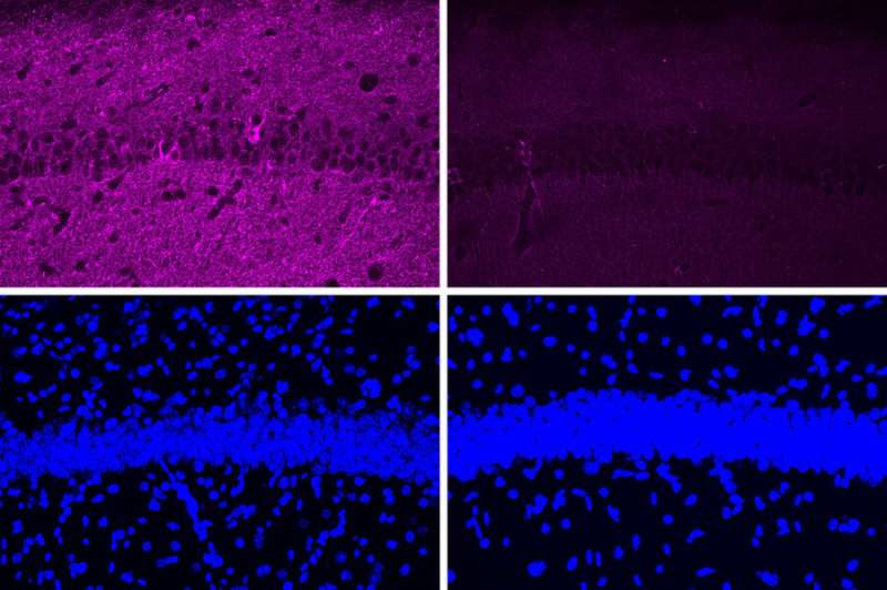 A new peptide may hold potential as an Alzheimer's treatment | MIT News