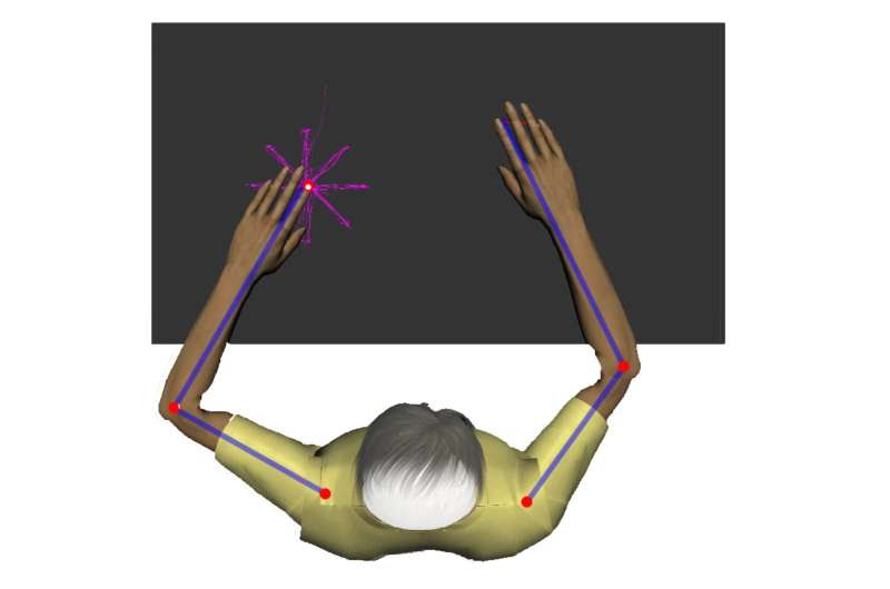 Brain stimulation shows beneficial effects for motor deficits following stroke