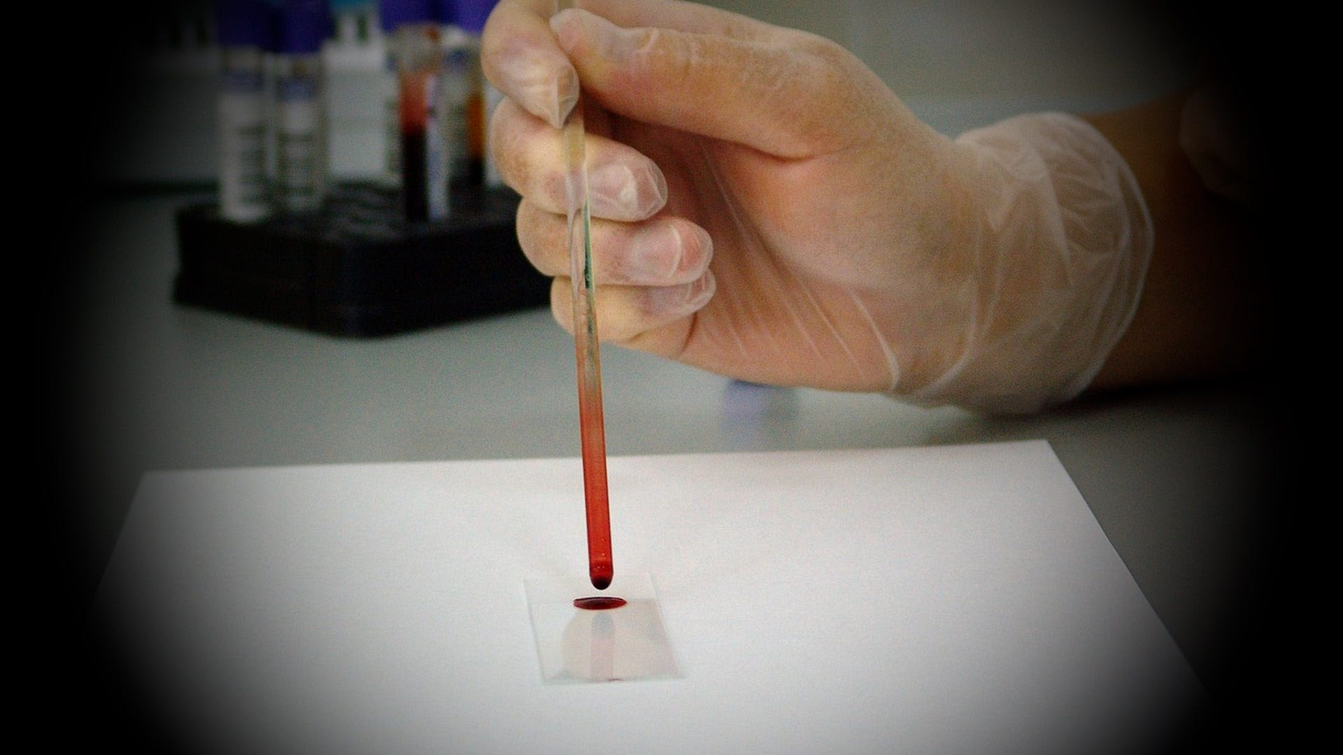 Dr. Ana Mihalcea & Clifford Carnicom: What Is Happening to Humanity’s Blood? — On the Loss of Electrical Blood Conductivity in the Post C19 Era Https%3A%2F%2Fsubstack-post-media.s3.amazonaws.com%2Fpublic%2Fimages%2F0778959d-b221-45b9-b355-a724744cd1bd_1920x1080
