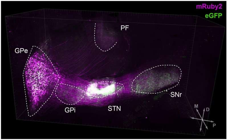 Distinct Parkinson's disease symptoms tied to different brain pathways