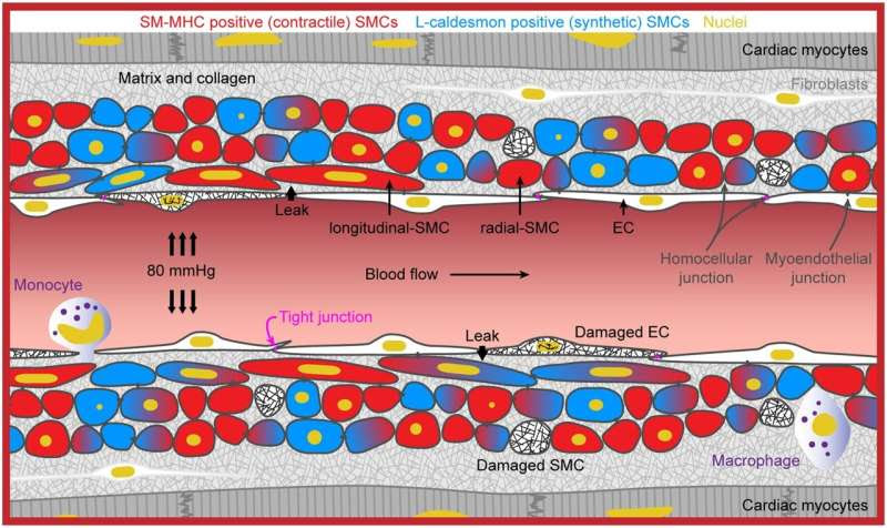 New research lifts the lid on cardiac microvascular dysfunction