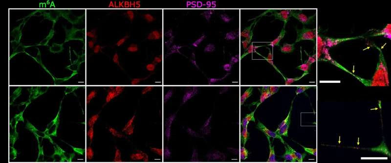 Scientists gain new understanding of how brain cells talk - which could help in the treatment of mental health conditions and me