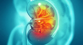 transparent kidney