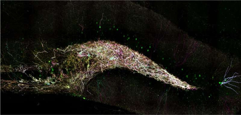 How sleep loss sabotages new memory storage in the hippocampus