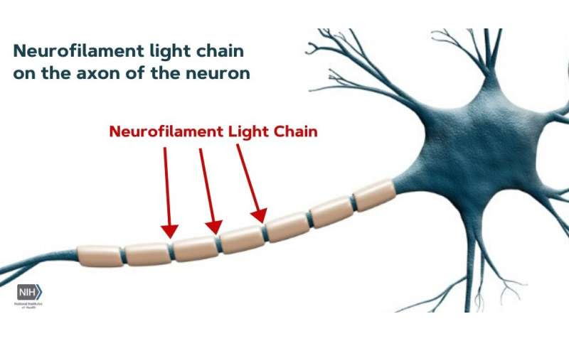 Blood-based biomarker can detect, predict severity of traumatic brain injury