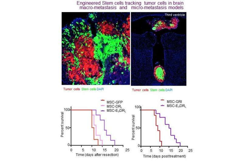 Engineered 'off the shelf' stem cells target breast cancer that metastasizes to the brain