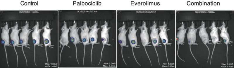 New gene targets for treating adult blood cancer