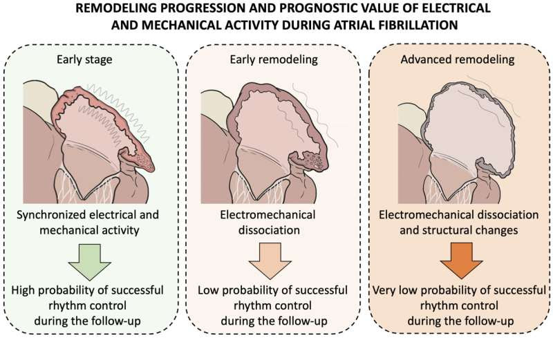 A new technique offers improved diagnostic precision and a route to personalized therapy for a common arrhythmia that affects mo