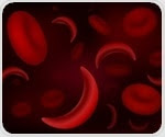 Overabundance of gut bacteria may exacerbate pain in patients with sickle cell disease