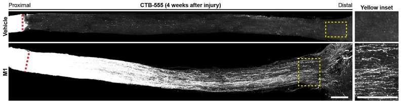 Neuroscientists identify a small molecule that restores visual function after optic nerve injury