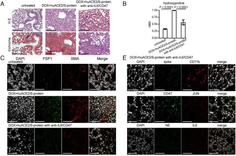 A possible way to prevent or treat lung damage associated with long COVID