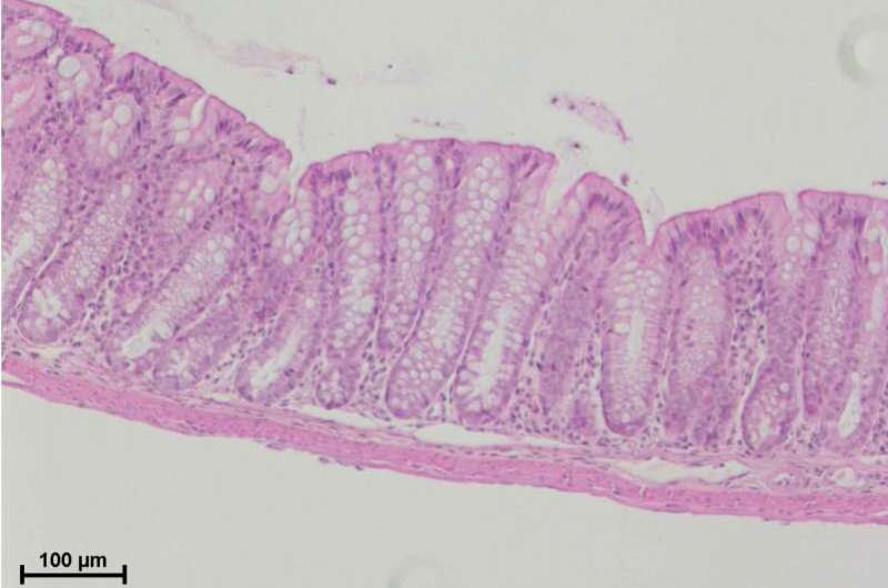 Mystery protein points to new immune 'smoke detector'