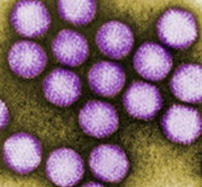 Adenovirus.  Image courtesy of CDC Public Health Image Library