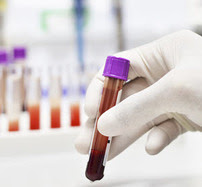 Blood samples in a lab