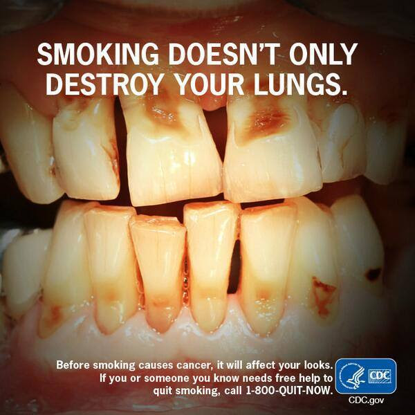Smoking doesn't only destroy your lungs. Before smoking causes cancer, it will affect your looks.
