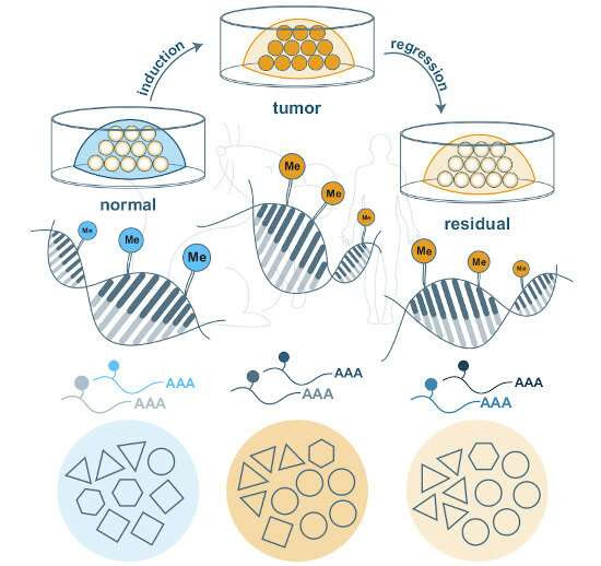 Metabolic memory plays a key role in breast cancer relapse