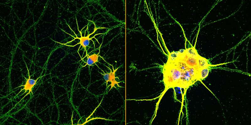 Mature 'lab grown' neurons hold promise for neurodegenerative disease