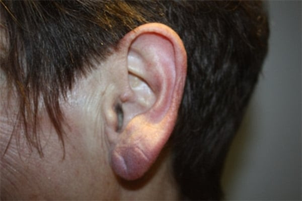 Bạn có nghĩ vành tai khô, khác thường là do cơ thể đã