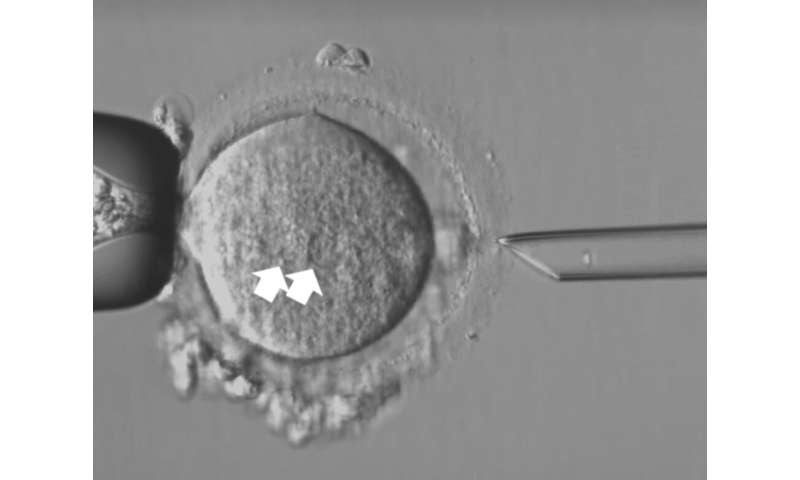 'Maeve's law' would let IVF parents access technology to prevent mitochondrial disease—ere's what the Senate is debating