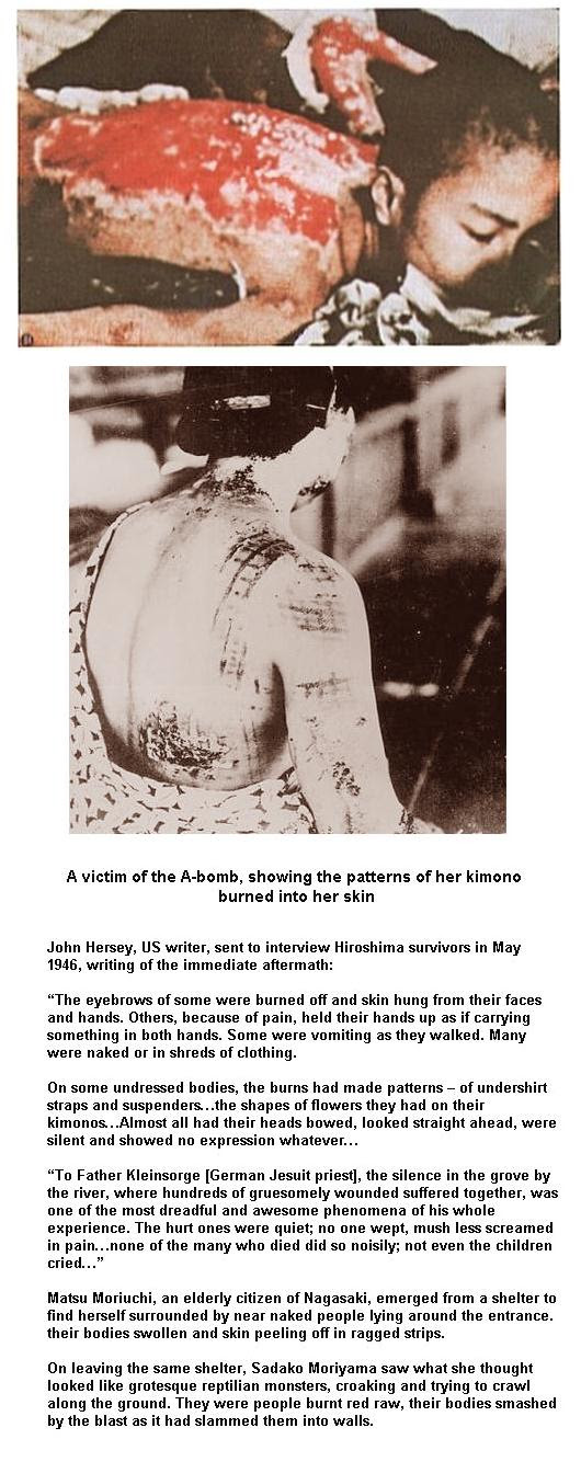 Fig 9 A-Bomb Radiation Injuries