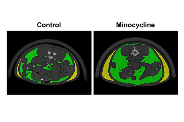 Minocycline Therapy Increases Adiposity