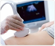 Low-cost upgrade of 2D ultrasound machines into 3D imaging devices