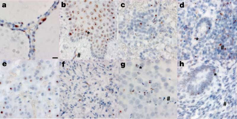 Autopsies show COVID-19 virus in brain, elsewhere in body