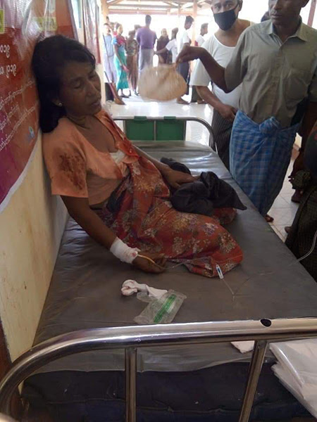 Một người phụ nữ bị thương trong vụ tấn công ở Arakan Nhà nước