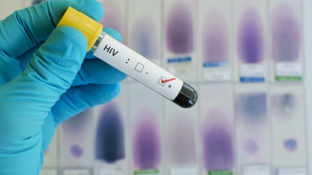 HIV: OMS recomenda uso de remédio injetável para prevenir infecção pelo vírus
