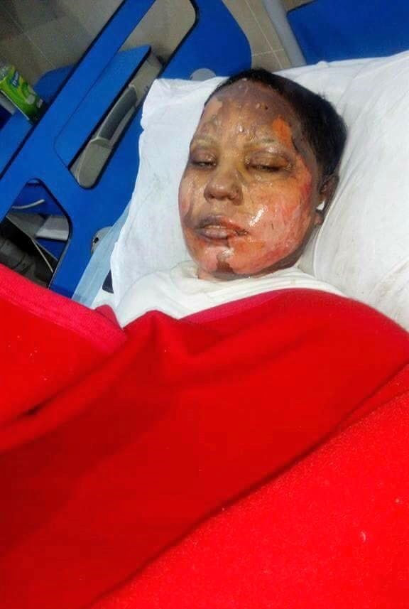  Asma Yaqoob succumbed to her injuries on Sunday night (April 22) after attack last week. (Morning Star News)