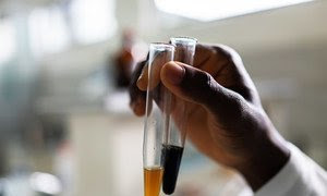 Un trabajador de laboratorio extrae ingredientes de plantas en Ghana, donde alrededor del 70% de los pacientes usan medicina herbolaria.