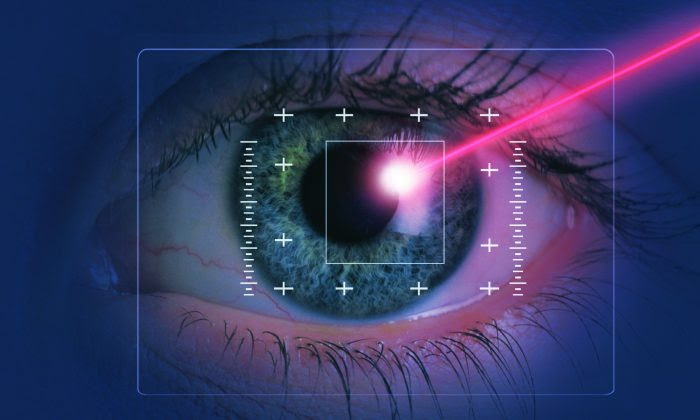 Myopia Laser Surgery: Sight Restoration or Blindness? What the Experts Aren’t Telling You