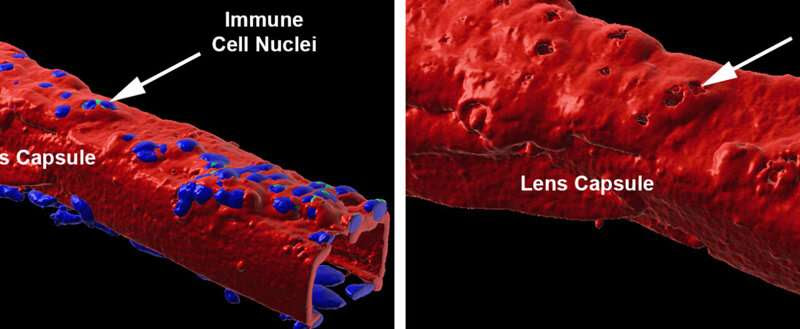 Reimagining immunity in the eye