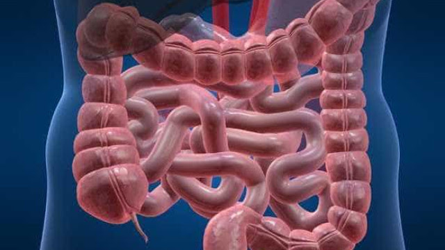 6 mitos e verdades sobre a doença de Crohn