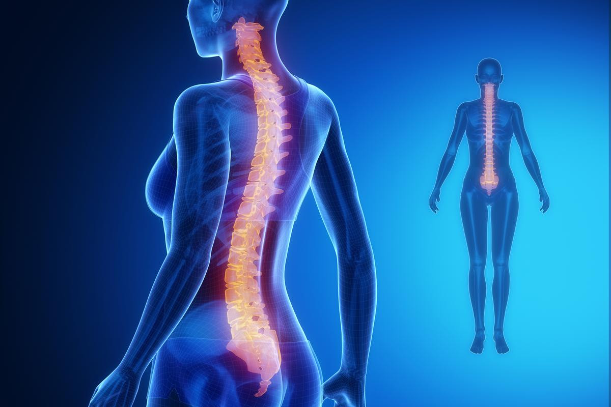 Spasticity, a side effect that occurs in around 70 percent of spinal cord injury sufferers, could be alleviated by an already approved drug