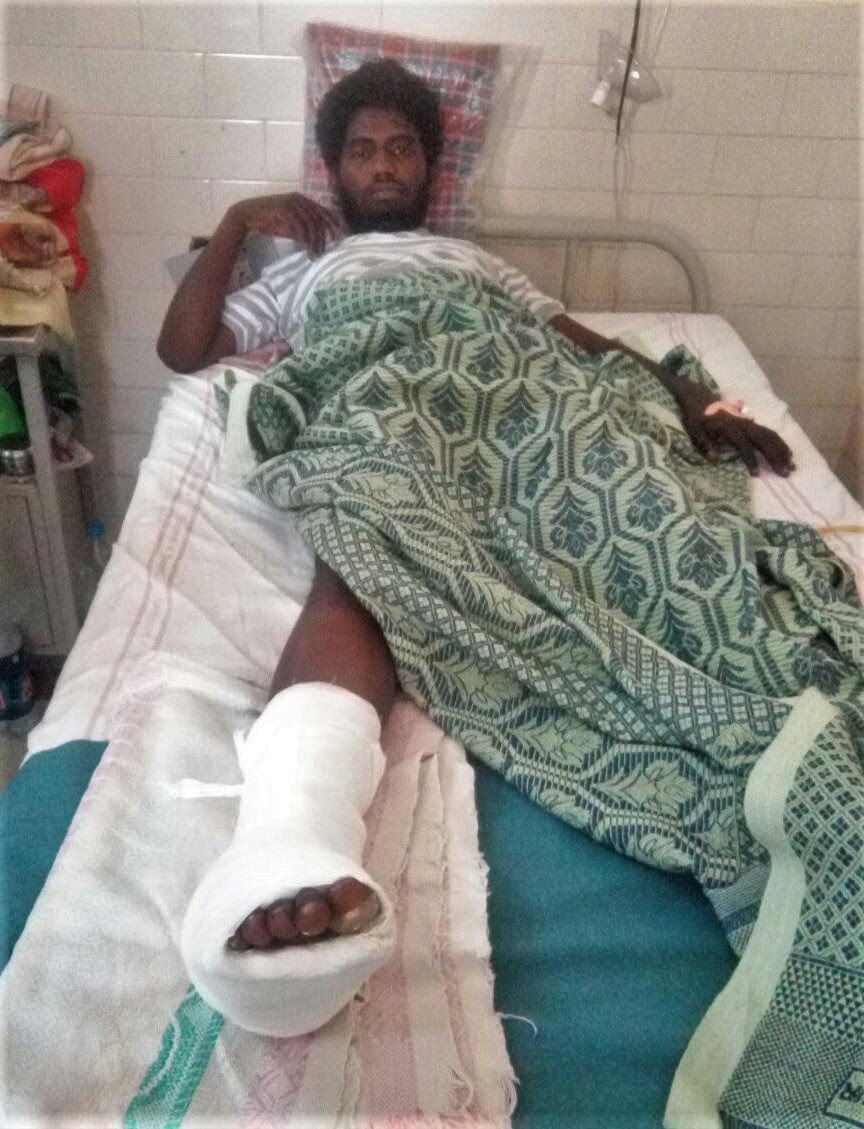  Kolhapuri Immanuel, 20, after surgery for broken foot bone. (Morning Star News)