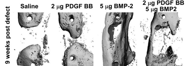 Combining two bone healing remedies can inhibit bone growth and regeneration