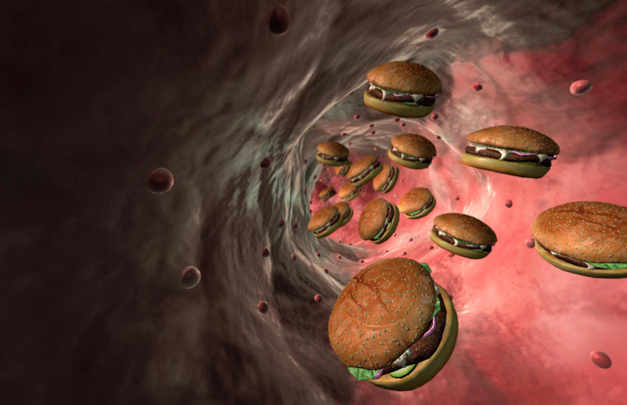 Have High Cholesterol? Then You’re Going To Want To Hear This! BIG Pharma Will Go Out-Of-Business! Have High Cholesterol? Then You’re Going To Want To Hear This! BIG Pharma Will Go Out-Of-Business!