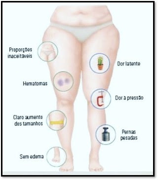 Lipedema X Linfedema – Dra Thaís Vascular