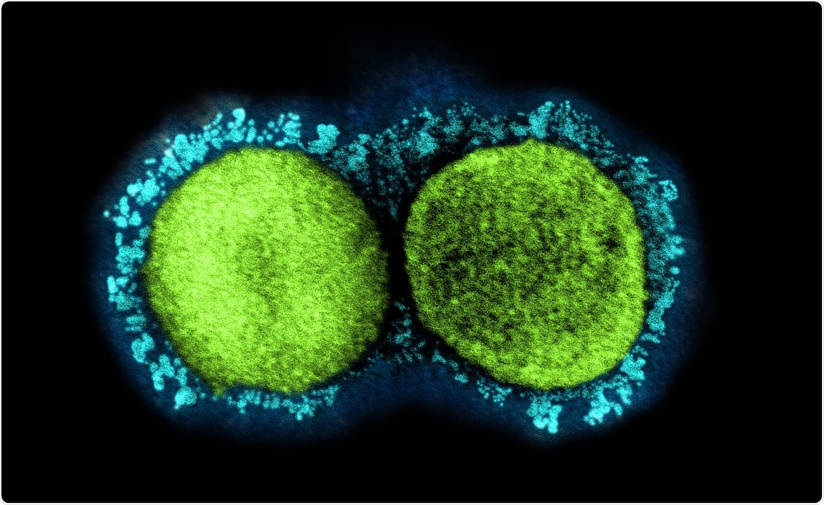 Study: Evidence for increased breakthrough rates of SARS-CoV-2 variants of concern in BNT162b2 mRNA vaccinated individuals. Image Credit: NIAID