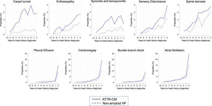 Machine-learning model can detect rare cardiomyopathy