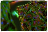 Avoiding Cell Death in Fluorescence Microscopy