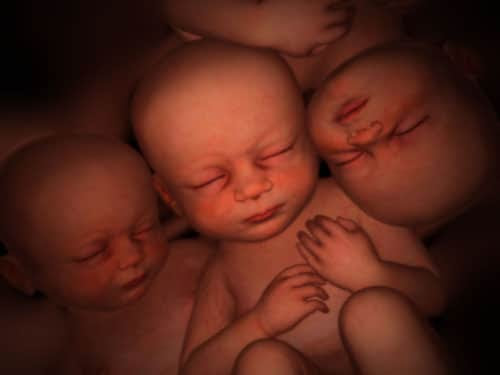 Surrogate mother defies contracting parents by
refusing to abort one of the triplets she is expecting