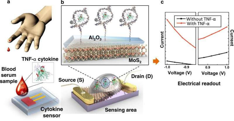 Scientists developing early Alzheimer's disease detection sensor