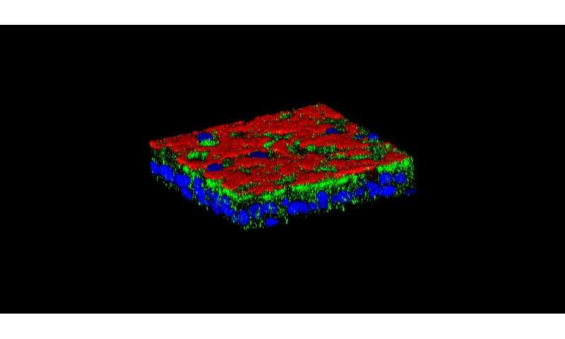 Cystic fibrosis: why so many respiratory complications?