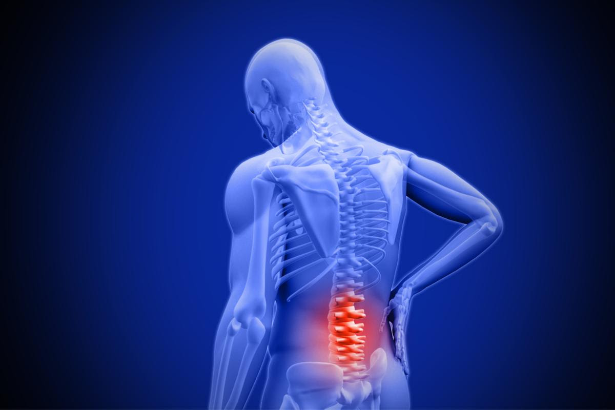 Scientists have found that a relatively new class of drugs known as senolytics can prevent spinal disc degeneration in mice